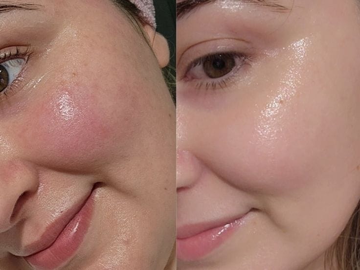 Before and after using the Bio-Collagen Facial Sheet Masks